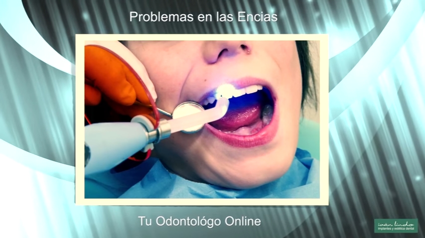 problemas en las encias